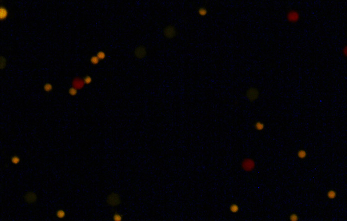 Fluorescence Microscopy using an OD 6 Filter