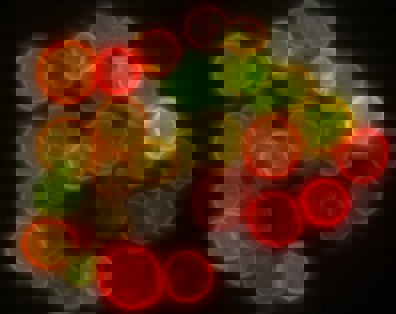 Figure 1: An image of protoplasts captured using confocal microscopy (left) that is more finely focused than an image of microspheres of a similar size captured using conventional epi-fluorescence microscopy.