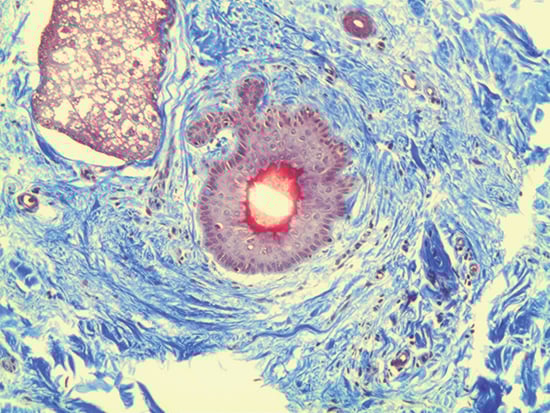 Trichrome Stain of Dermal Tissue Samples at 10X Magnification