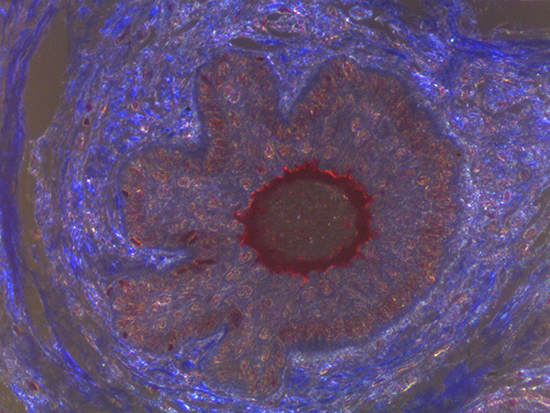 Darkfield Imaging of Dermal Tissue